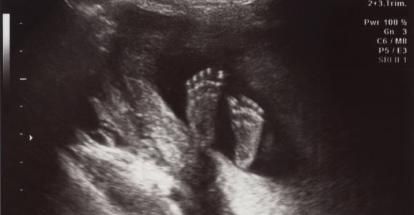 3 Value Statements Needed in The Pro-Life Movement